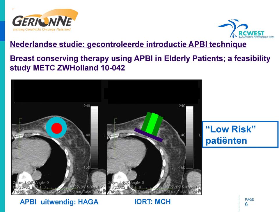 Patients; a feasibility study METC ZWHolland 10-042 Low