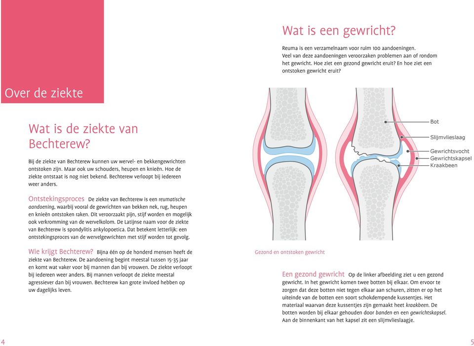 Maar ook uw schouders, heupen en knieën. Hoe de ziekte ontstaat is nog niet bekend. Bechterew verloopt bij iedereen weer anders.