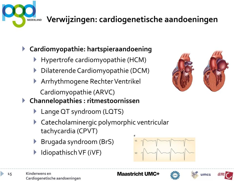 Cardiomyopathie (ARVC) Channelopathies : ritmestoornissen Lange QT syndroom (LQTS)