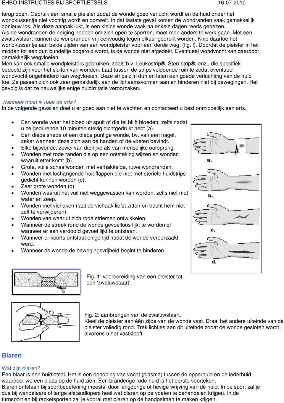 Als de wondranden de neiging hebben om zich open te sperren, moet men anders te werk gaan. Met een zwaluwstaart kunnen de wondranden vrij eenvoudig tegen elkaar gedrukt worden.