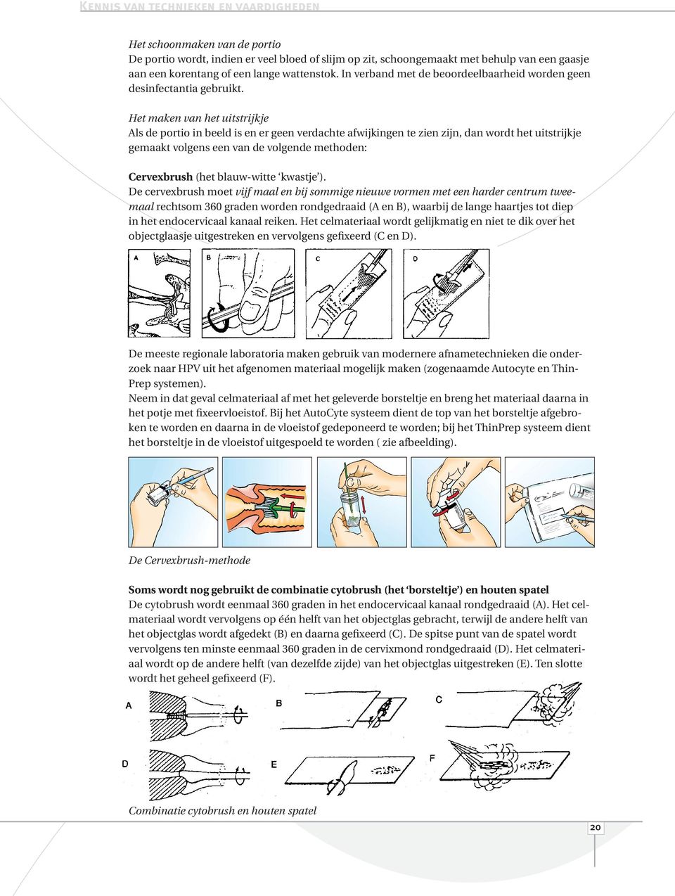 Het maken van het uitstrijkje Als de portio in beeld is en er geen verdachte afwijkingen te zien zijn, dan wordt het uitstrijkje gemaakt volgens een van de volgende methoden: Cervexbrush (het