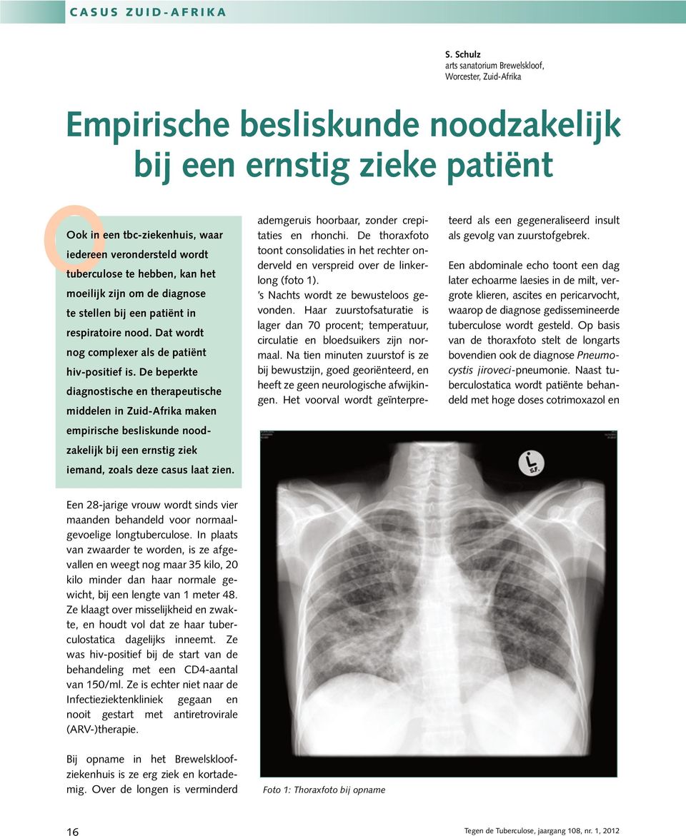 te hebben, kan het moeilijk zijn om de diagnose te stellen bij een patiënt in respiratoire nood. Dat wordt nog complexer als de patiënt hiv-positief is.