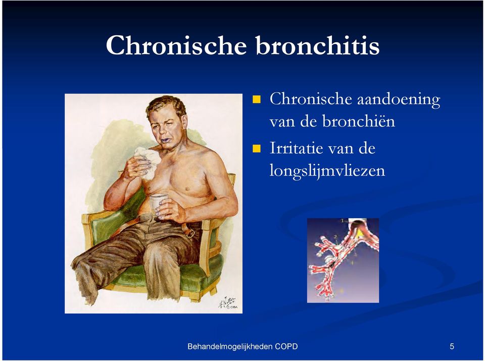 van de bronchiën