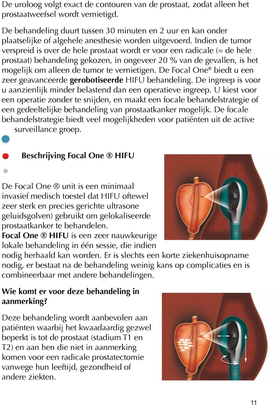 Indien de tumor verspreid is over de hele prostaat wordt er voor een radicale (= de hele prostaat) behandeling gekozen, in ongeveer 20 % van de gevallen, is het mogelijk om alleen de tumor te