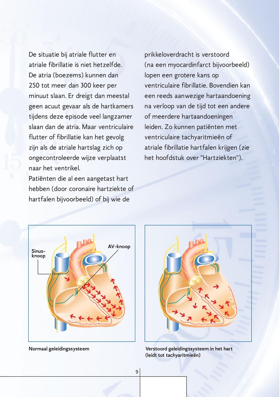 Maar ventriculaire flutter of fibrillatie kan het gevolg zijn als de atriale hartslag zich op ongecontroleerde wijze verplaatst naar het ventrikel.