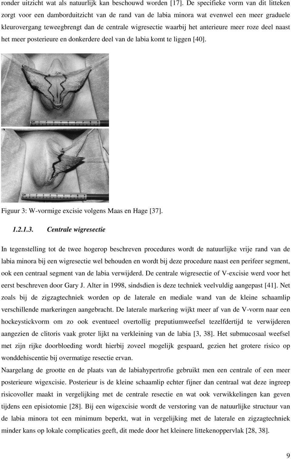 anterieure meer roze deel naast het meer posterieure en donkerdere deel van de labia komt te liggen [40]. Figuur 3: