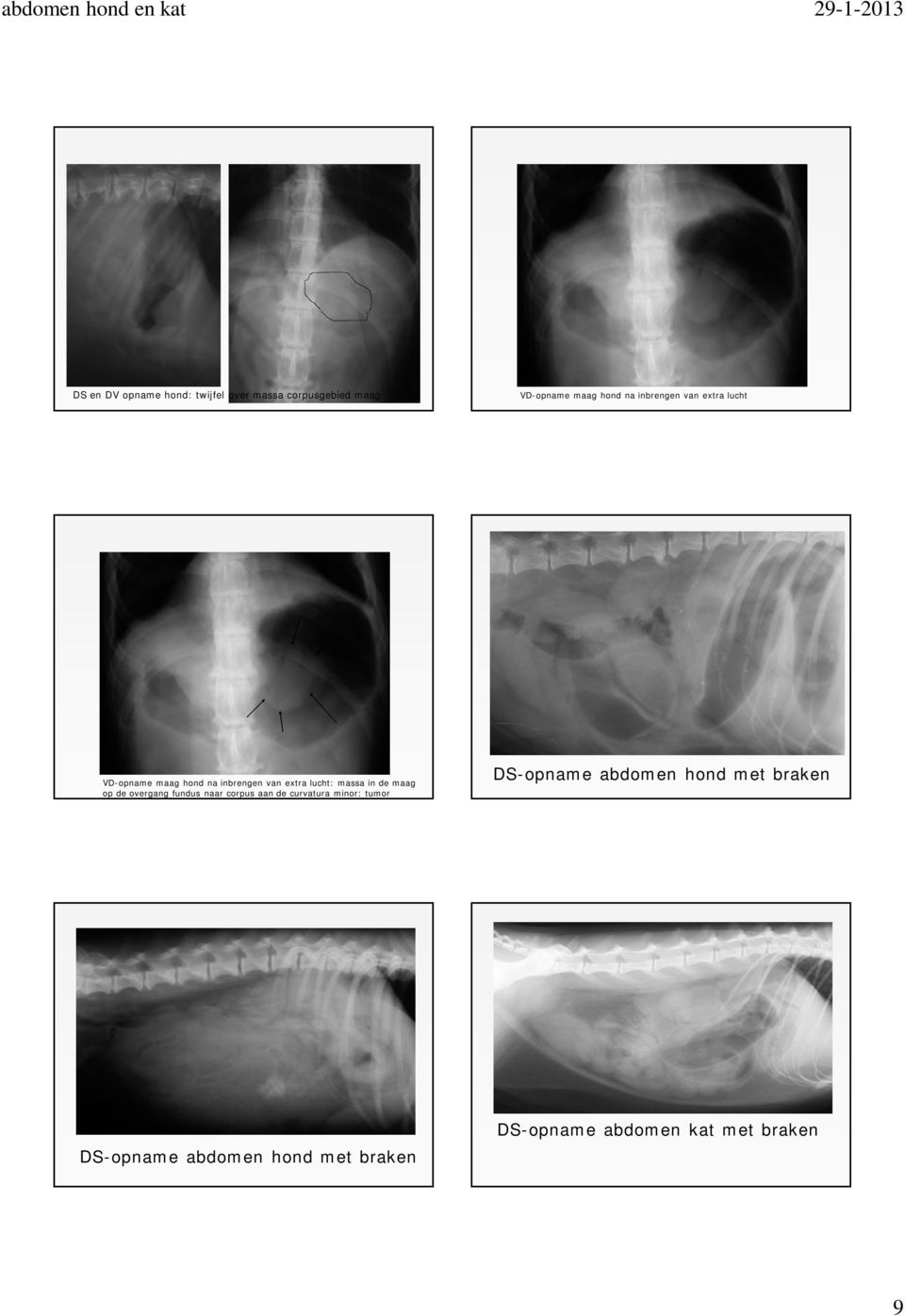 de maag op de overgang fundus naar corpus aan de curvatura minor: tumor DS-opname