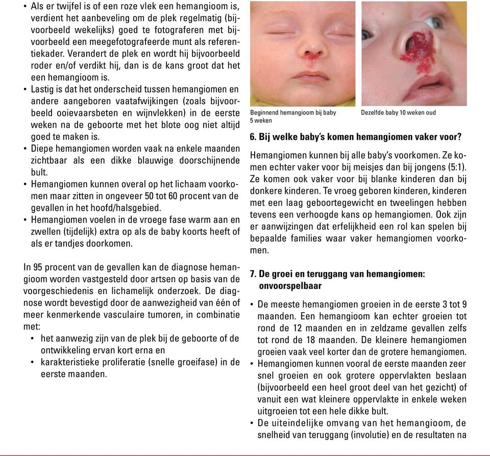Lastig is dat het onderscheid tussen hemangiomen en andere aangeboren vaatafwijkingen (zoals bijvoorbeeld ooievaarsbeten en wijnvlekken) in de eerste weken na de geboorte met het blote oog niet