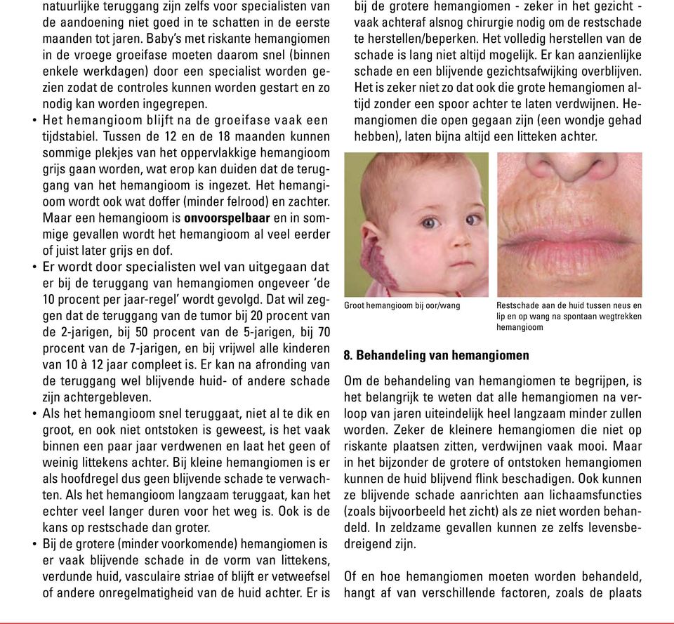 ingegrepen. Het hemangioom blijft na de groeifase vaak een tijdstabiel.
