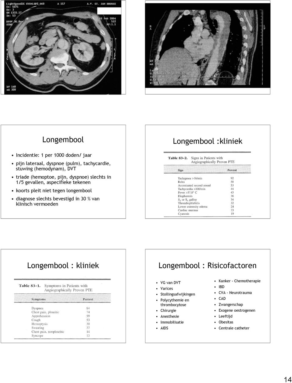 klinisch vermoeden Longembool : kliniek Longembool : Risicofactoren VG van DVT Varices Stollingsafwijkingen Polycythemie en thrombocytose