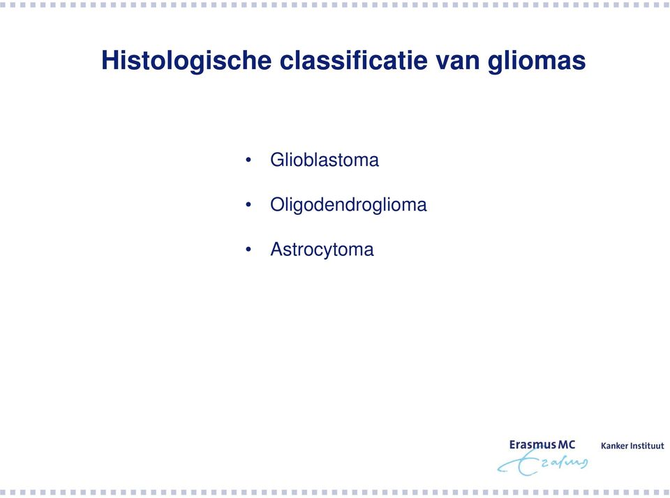 gliomas Glioblastoma