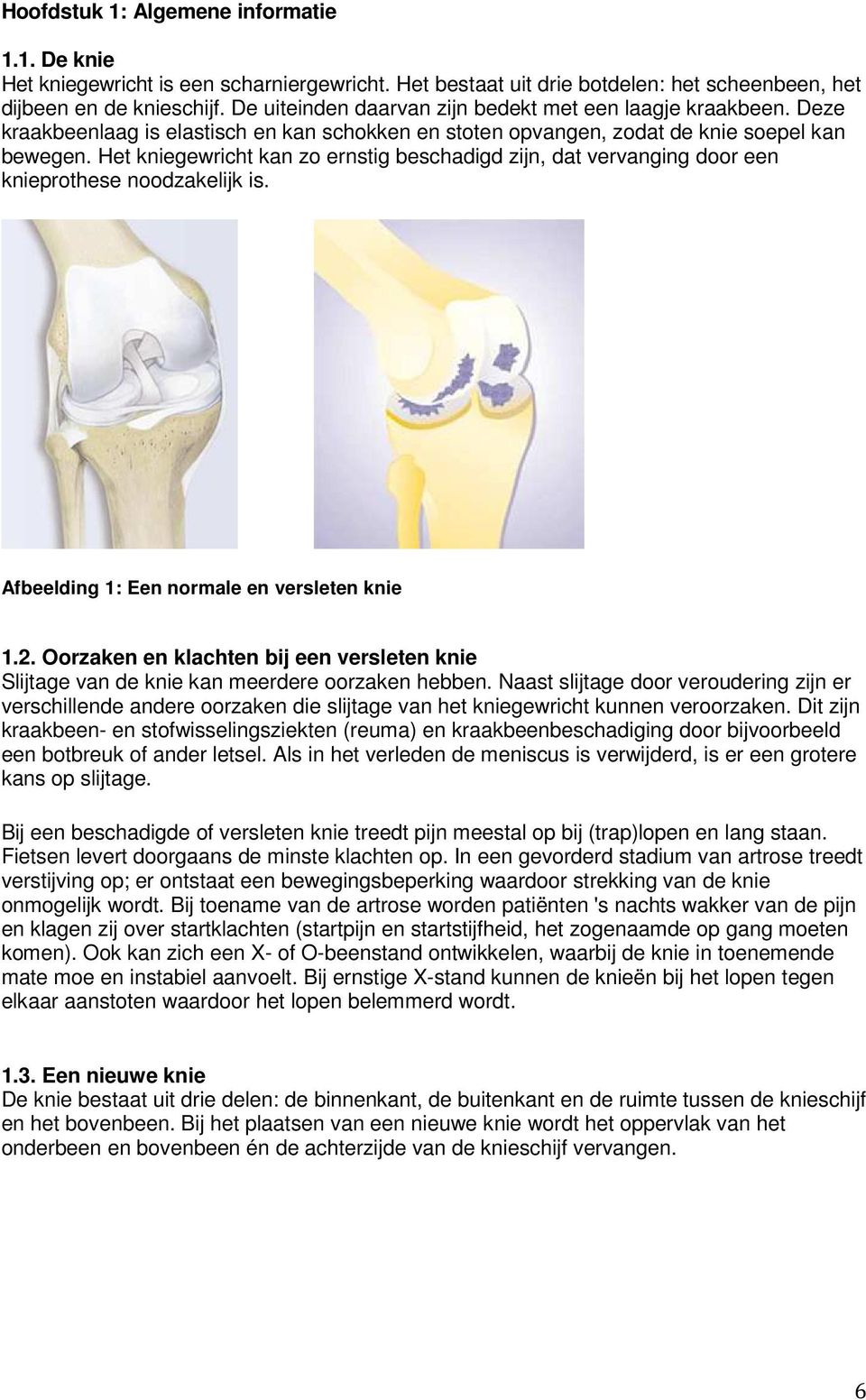 Het kniegewricht kan zo ernstig beschadigd zijn, dat vervanging door een knieprothese noodzakelijk is. Afbeelding 1: Een normale en versleten knie 1.2.