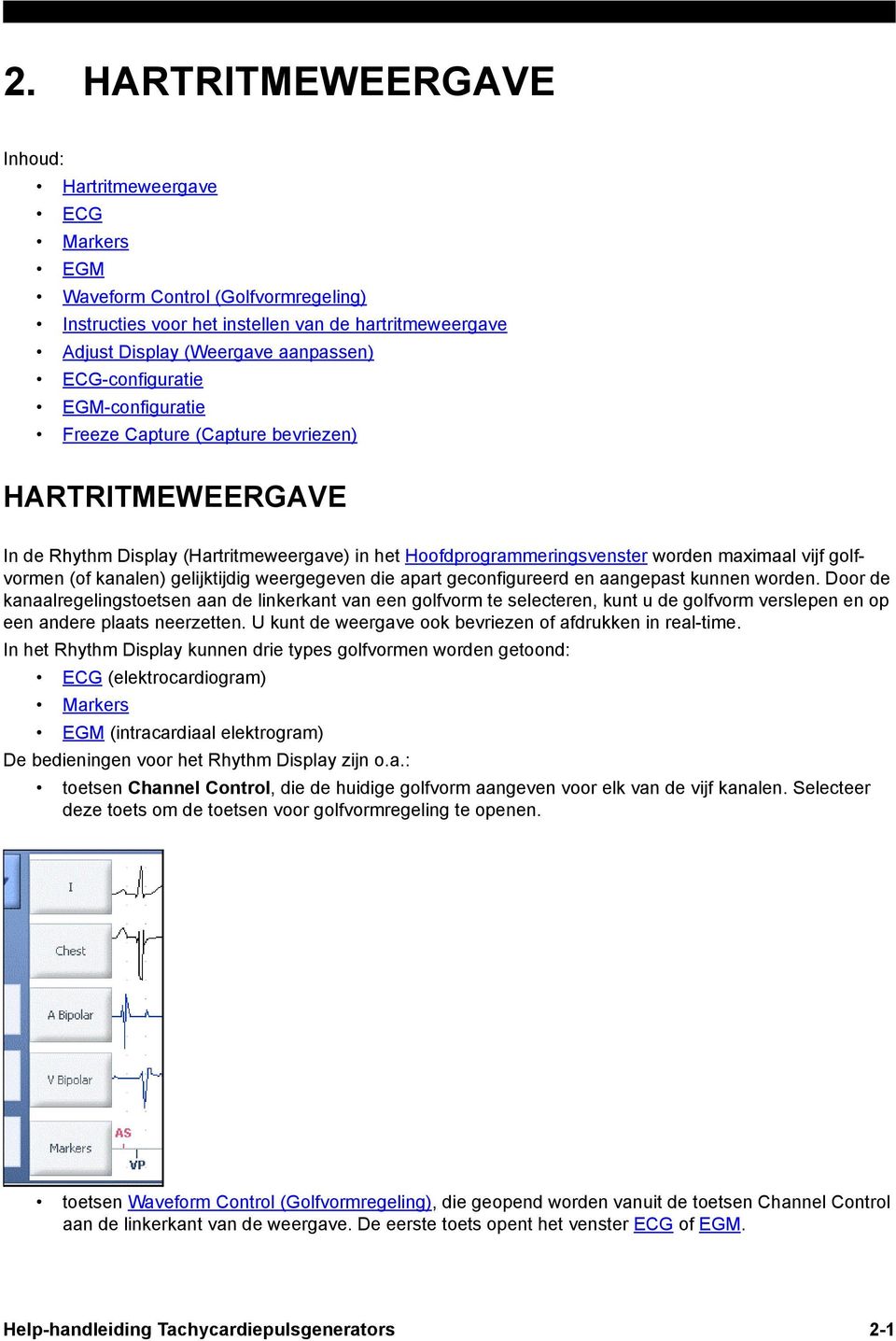 kanalen) gelijktijdig weergegeven die apart geconfigureerd en aangepast kunnen worden.