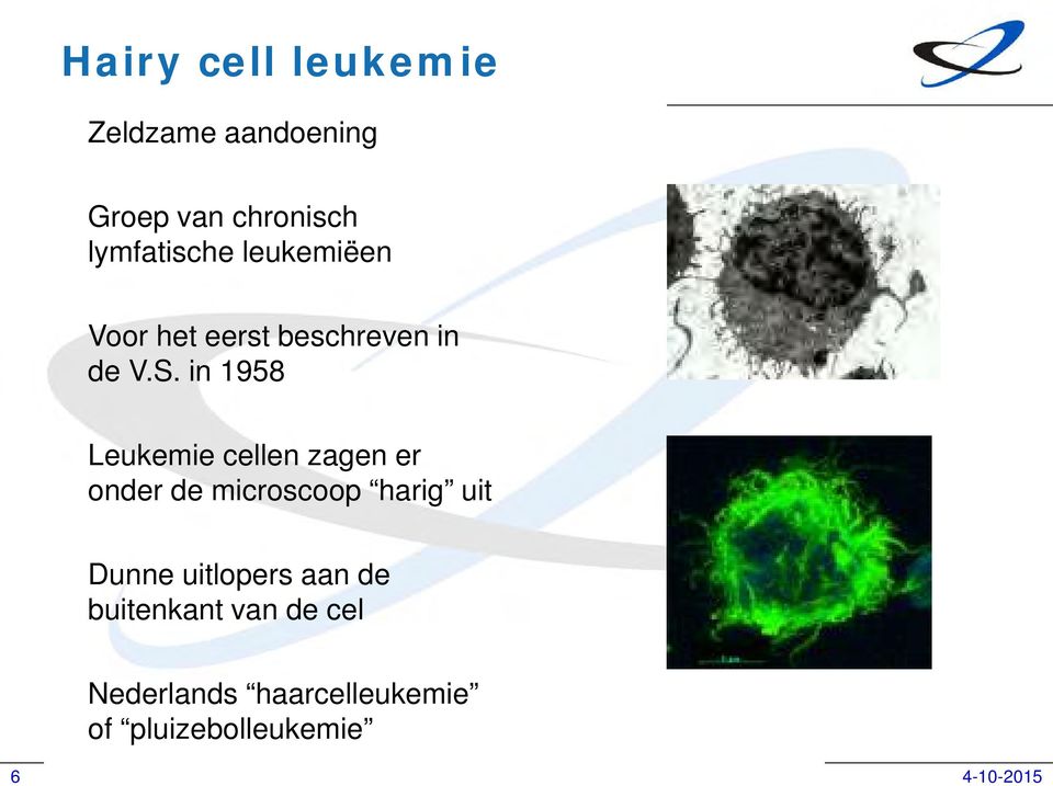 in 1958 Leukemie cellen zagen er onder de microscoop harig uit