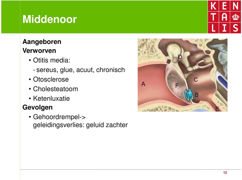 Cholesteatoom Ketenluxatie Gevolgen