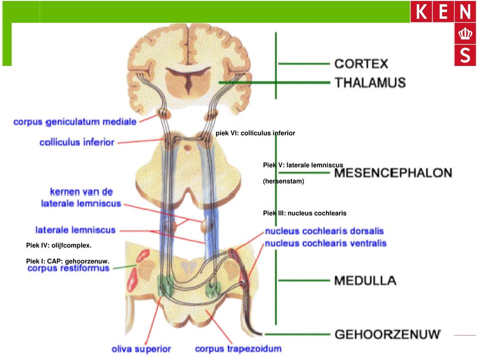 III: nucleus cochlearis Piek IV: