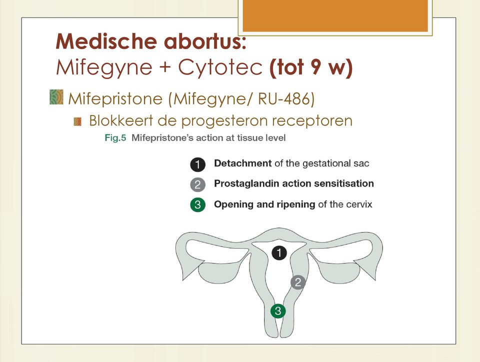 Mifepristone (Mifegyne/