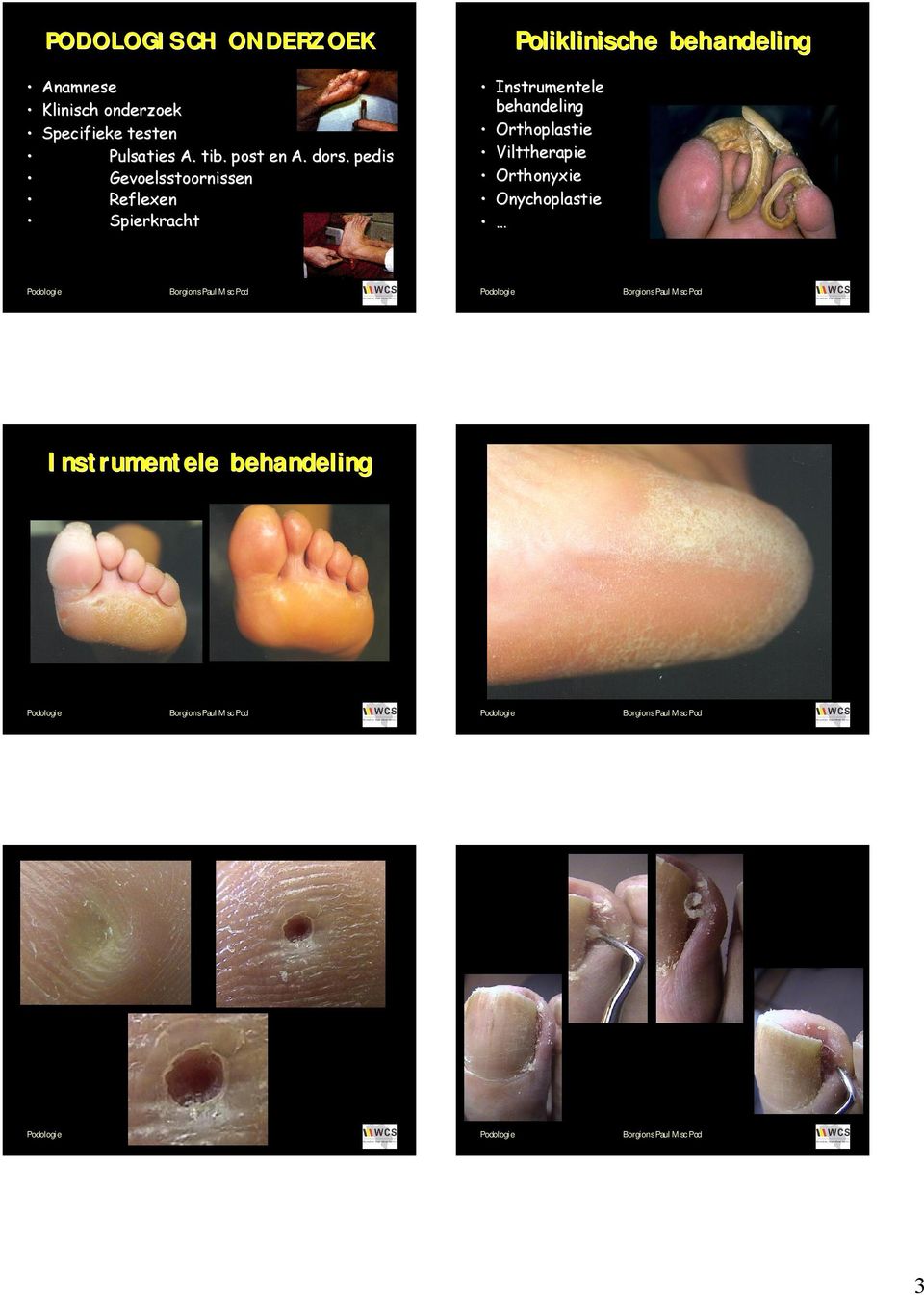 pedis Gevoelsstoornissen Reflexen Spierkracht Poliklinische