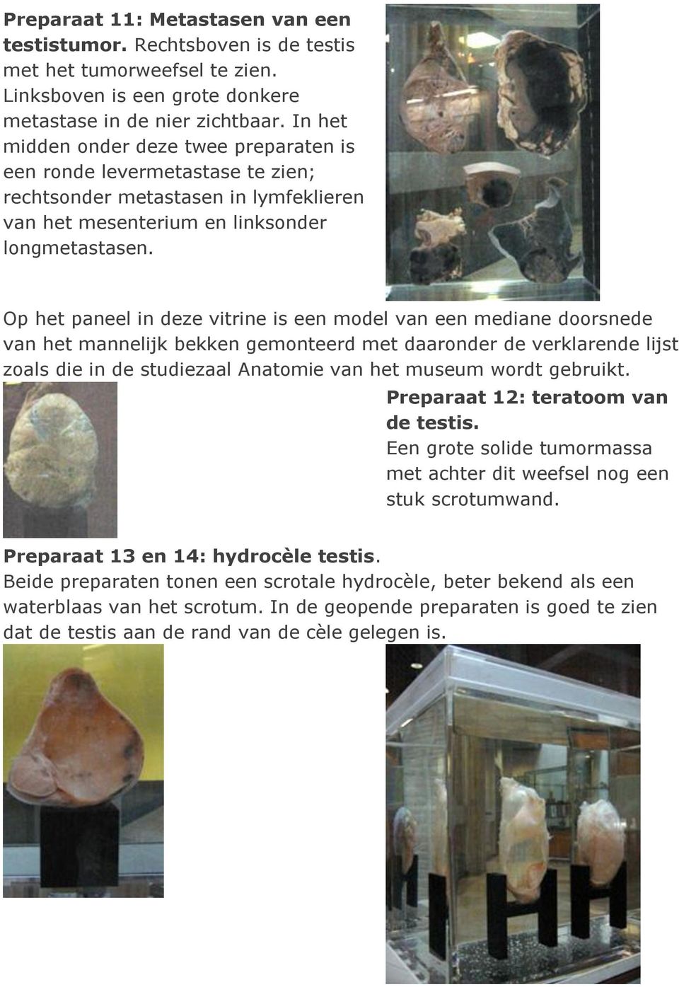 Op het paneel in deze vitrine is een model van een mediane doorsnede van het mannelijk bekken gemonteerd met daaronder de verklarende lijst zoals die in de studiezaal Anatomie van het museum wordt