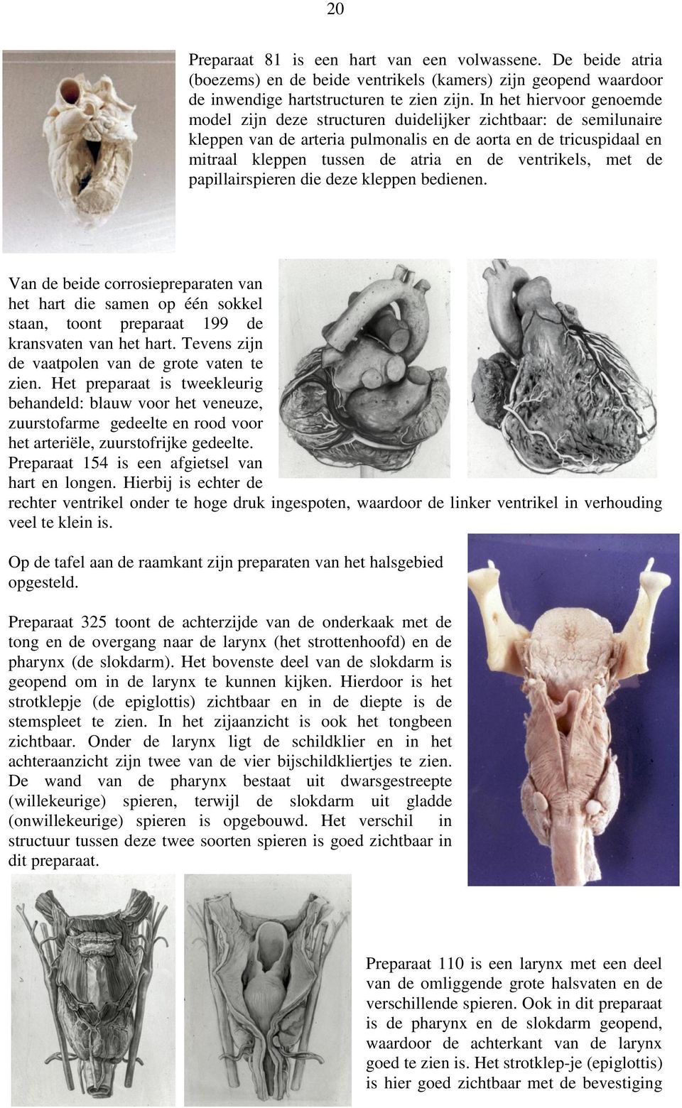 ventrikels, met de papillairspieren die deze kleppen bedienen. Van de beide corrosiepreparaten van het hart die samen op één sokkel staan, toont preparaat 199 de kransvaten van het hart.