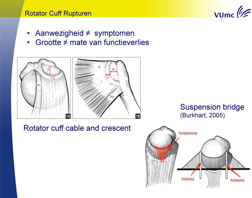 functieverlies Rotator cuff cable