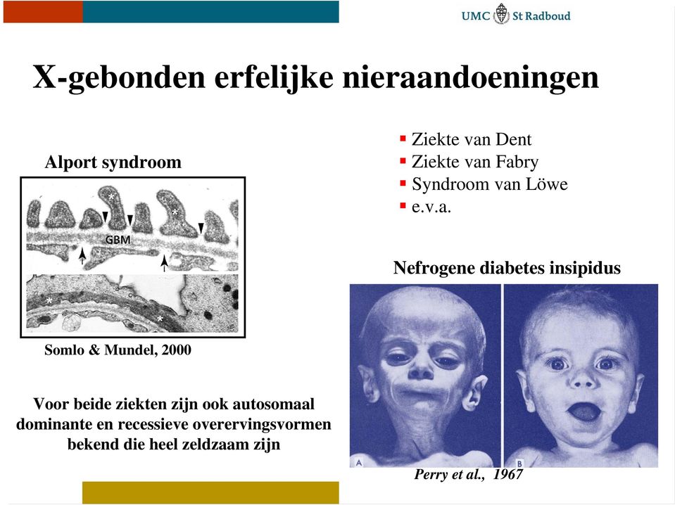 Fabry Syndroom van Löwe e.v.a. Nefrogene diabetes insipidus Somlo &