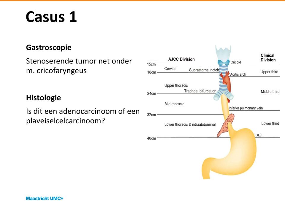 cricofaryngeus Histologie Is dit