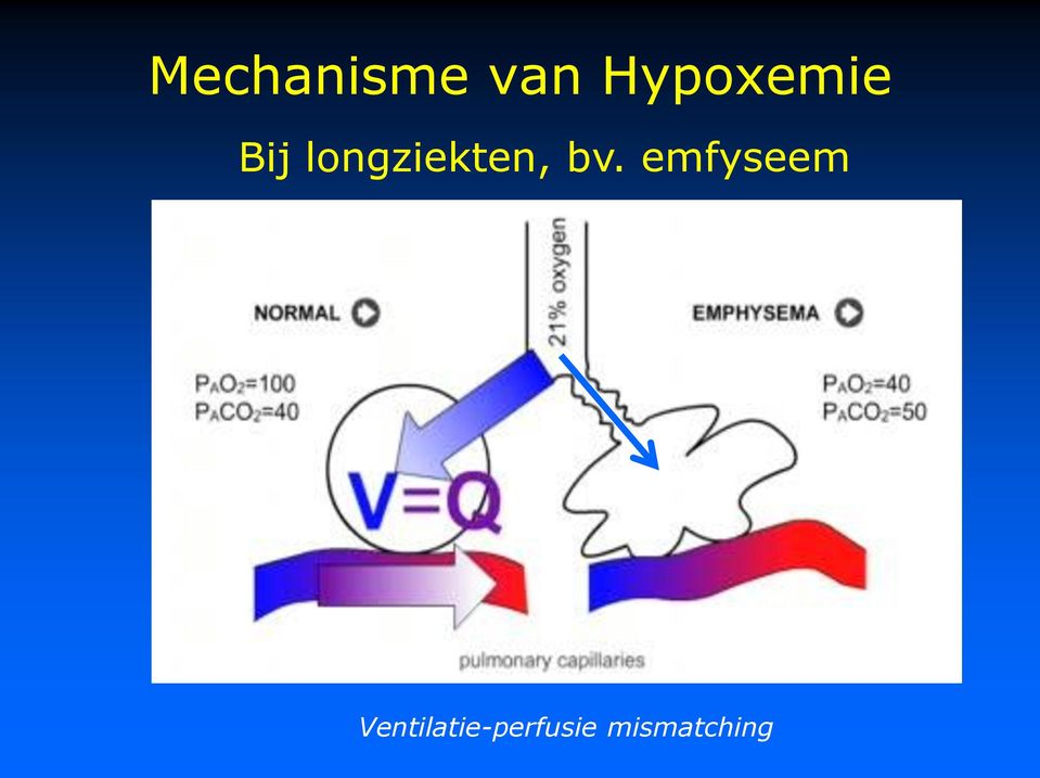 longziekten, bv.