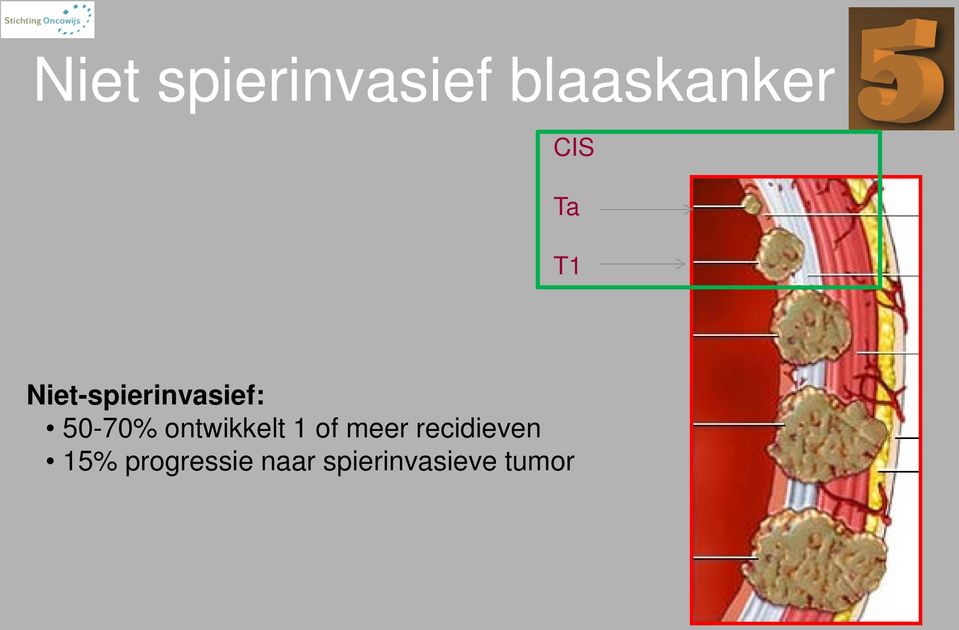 ontwikkelt 1 of meer recidieven