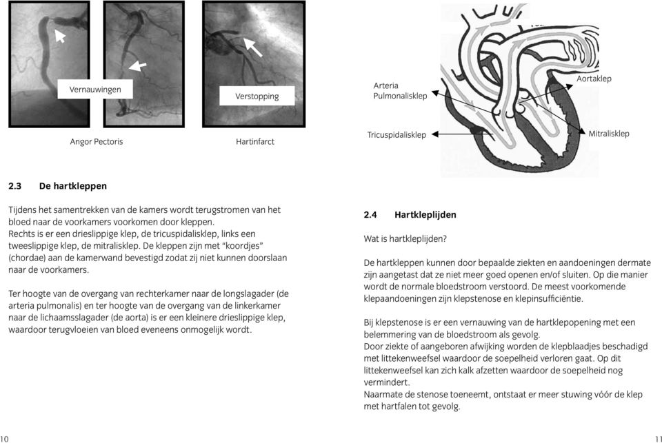 Rechts is er een drieslippige klep, de tricuspidalisklep, links een tweeslippige klep, de mitralisklep.