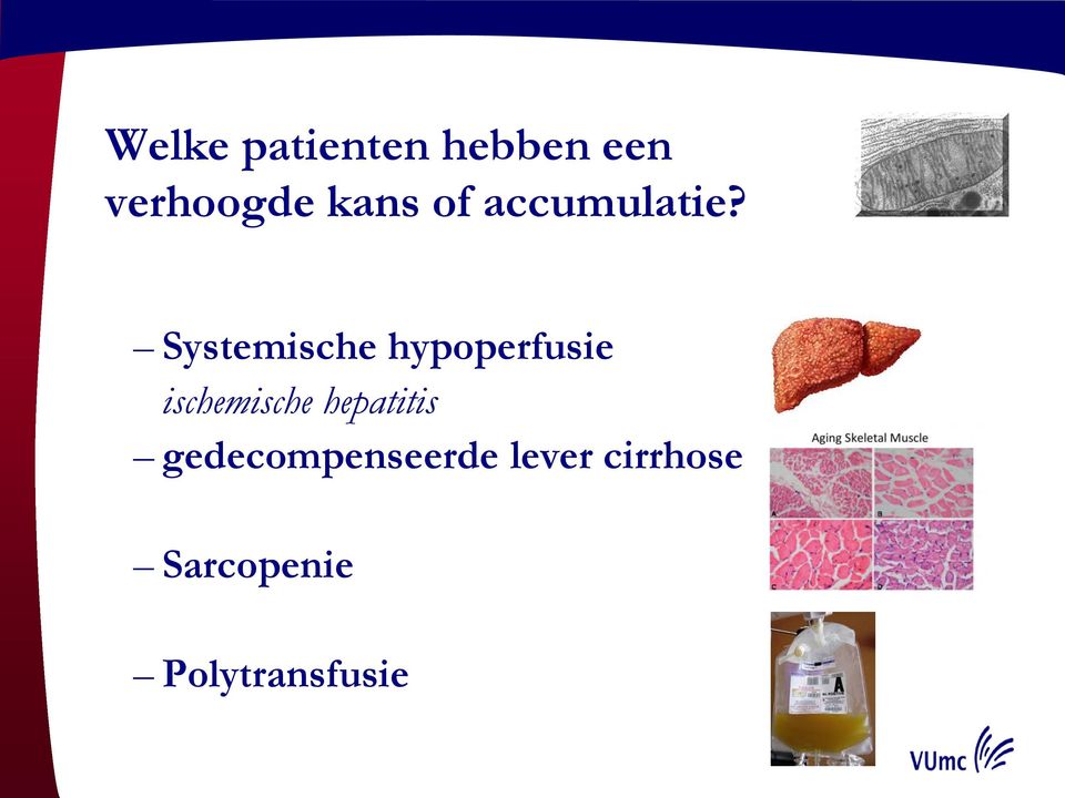 Systemische hypoperfusie ischemische