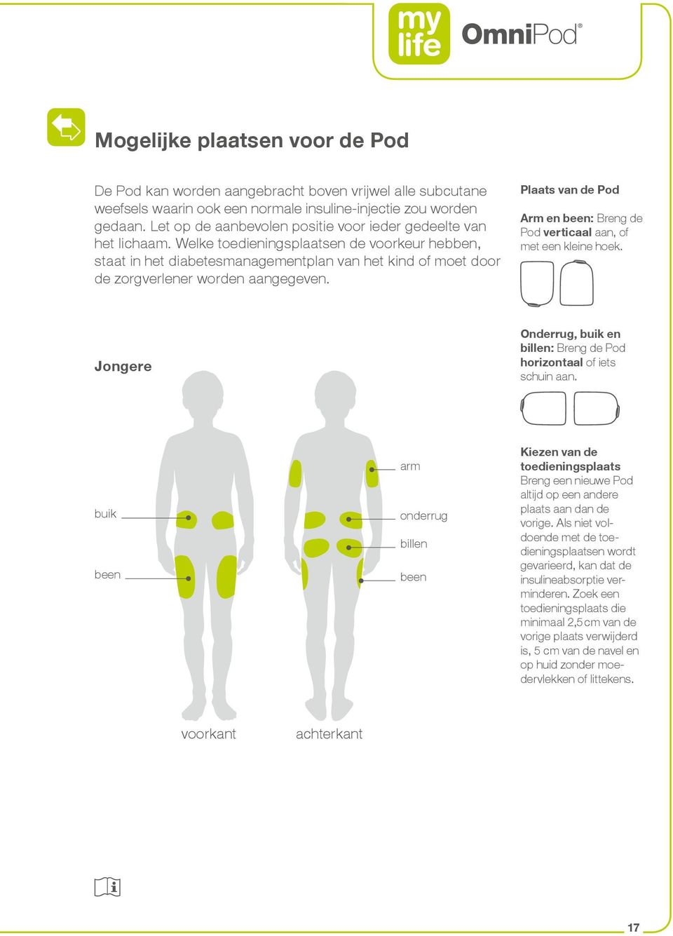 Welke toedieningsplaatsen de voorkeur hebben, staat in het diabetesmanagementplan van het kind of moet door de zorgverlener worden aangegeven.