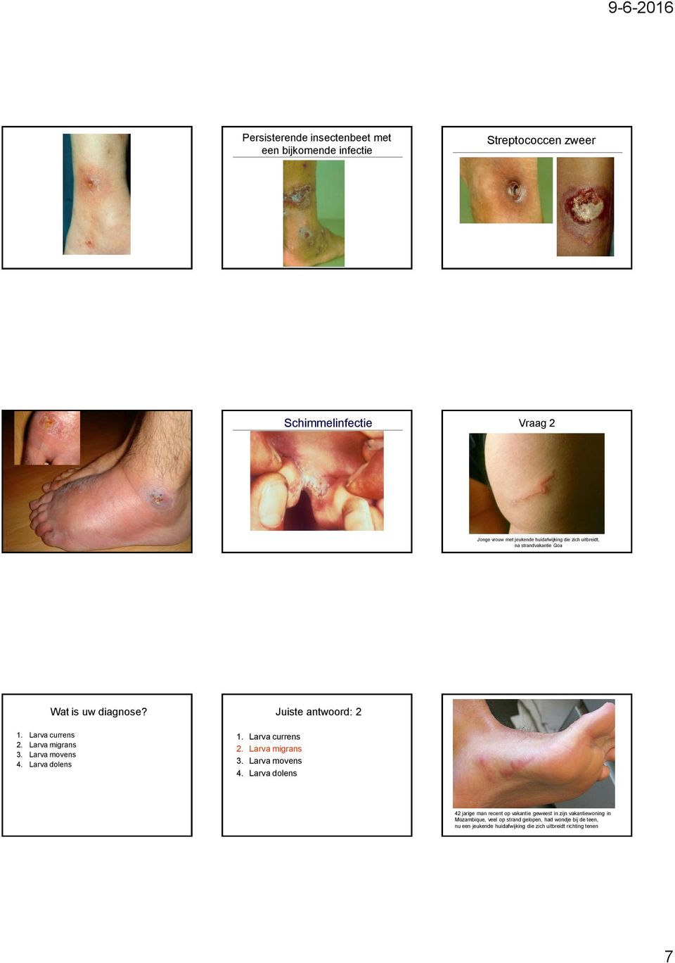 Larva dolens Wat is uw diagnose? 1. Larva currens 2. Larva migrans 3. Larva movens 4.