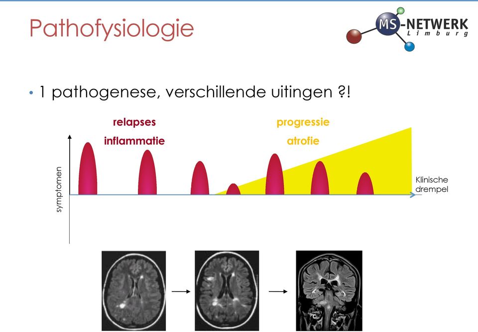 ! relapses inflammatie