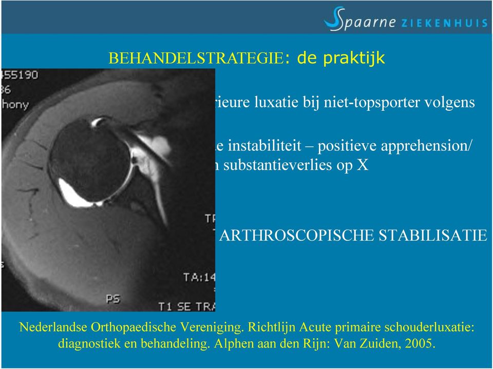(< 5) geen substantieverlies op X Aanvullend MRI arthro: ARTHROSCOPISCHE STABILISATIE Nederlandse