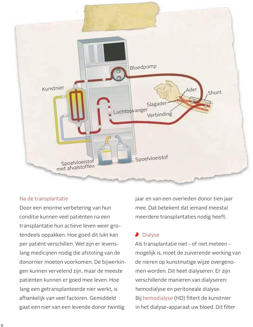 Wel zijn er levenslang medicijnen nodig die afstoting van de donornier moeten voorkomen. De bijwerkingen kunnen vervelend zijn, maar de meeste patiënten kunnen er goed mee leven.