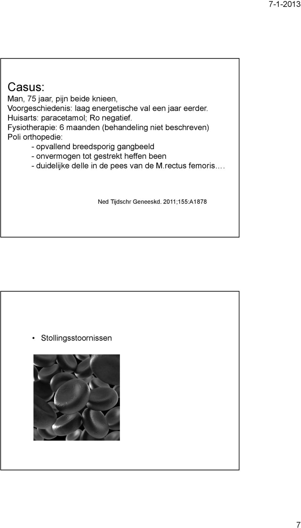 Fysiotherapie: 6 maanden (behandeling niet beschreven) Poli orthopedie: - opvallend breedsporig