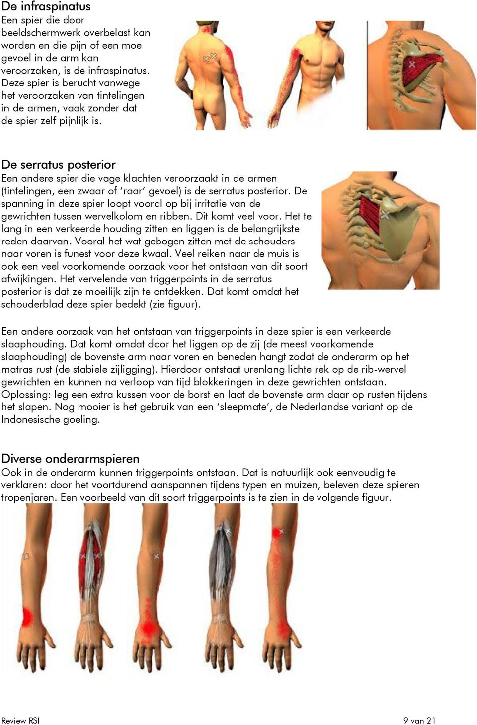 De serratus psterir Een andere spier die vage klachten verrzaakt in de armen (tintelingen, een zwaar f raar gevel) is de serratus psterir.