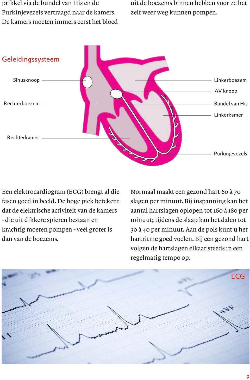 De hoge piek betekent dat de elektrische activiteit van de kamers - die uit dikkere spieren bestaan en krachtig moeten pompen - veel groter is dan van de boezems.