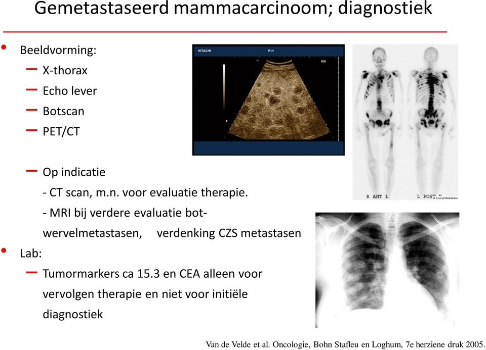 indicatie - CT scan, m.n. voor evaluatie therapie.