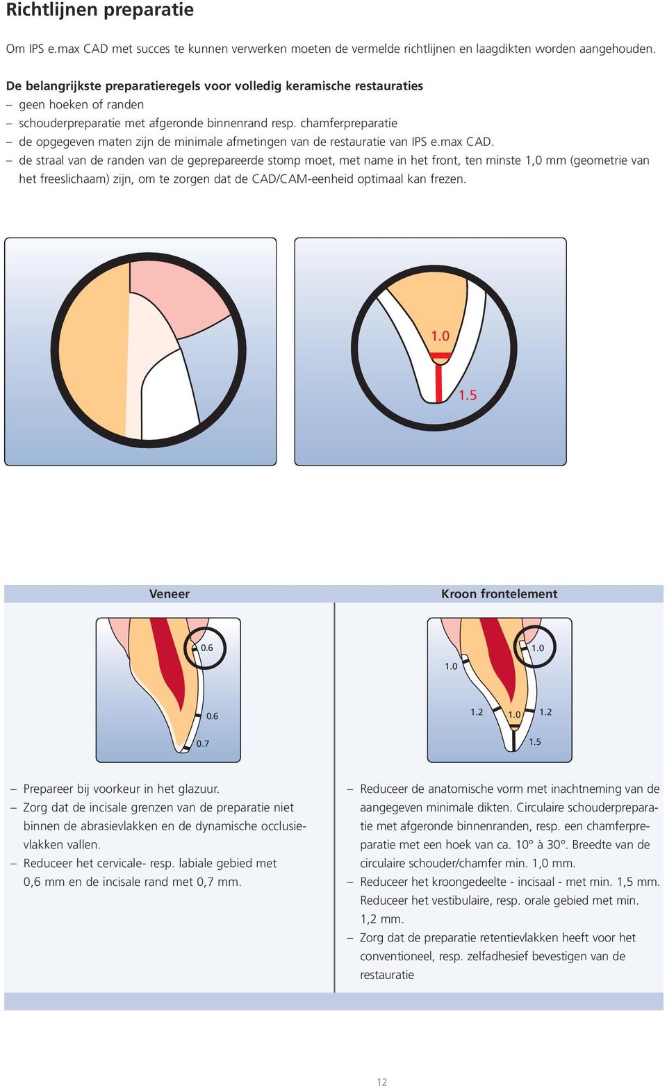 chamferpreparatie de opgegeven maten zijn de minimale afmetingen van de restauratie van IPS e.max CAD.