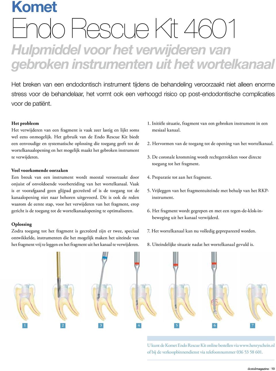 Het probleem Het verwijderen van een fragment is vaak zeer lastig en lijkt soms wel eens onmogelijk.