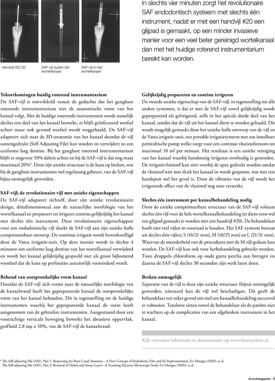 Handvijl ISO 20 SAF-vijl buiten het wortelkanaal SAF-vijl in het wortelkanaal Tekortkomingen huidig roterend instrumentarium De SAF-vijl is ontwikkeld vanuit de gedachte dat het gangbare roterende