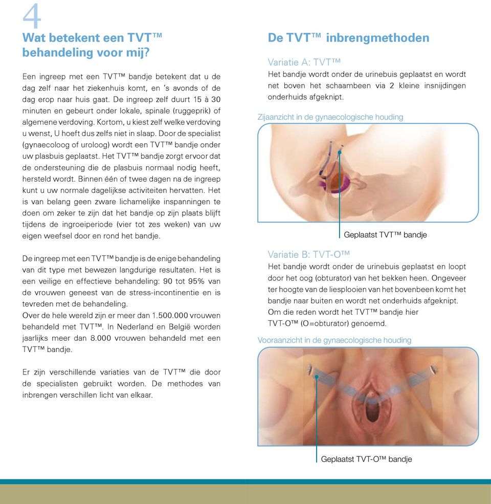 Door de specialist (gynaecoloog of uroloog) wordt een TVT bandje onder uw plasbuis geplaatst. Het TVT bandje zorgt ervoor dat de ondersteuning die de plasbuis normaal nodig heeft, hersteld wordt.