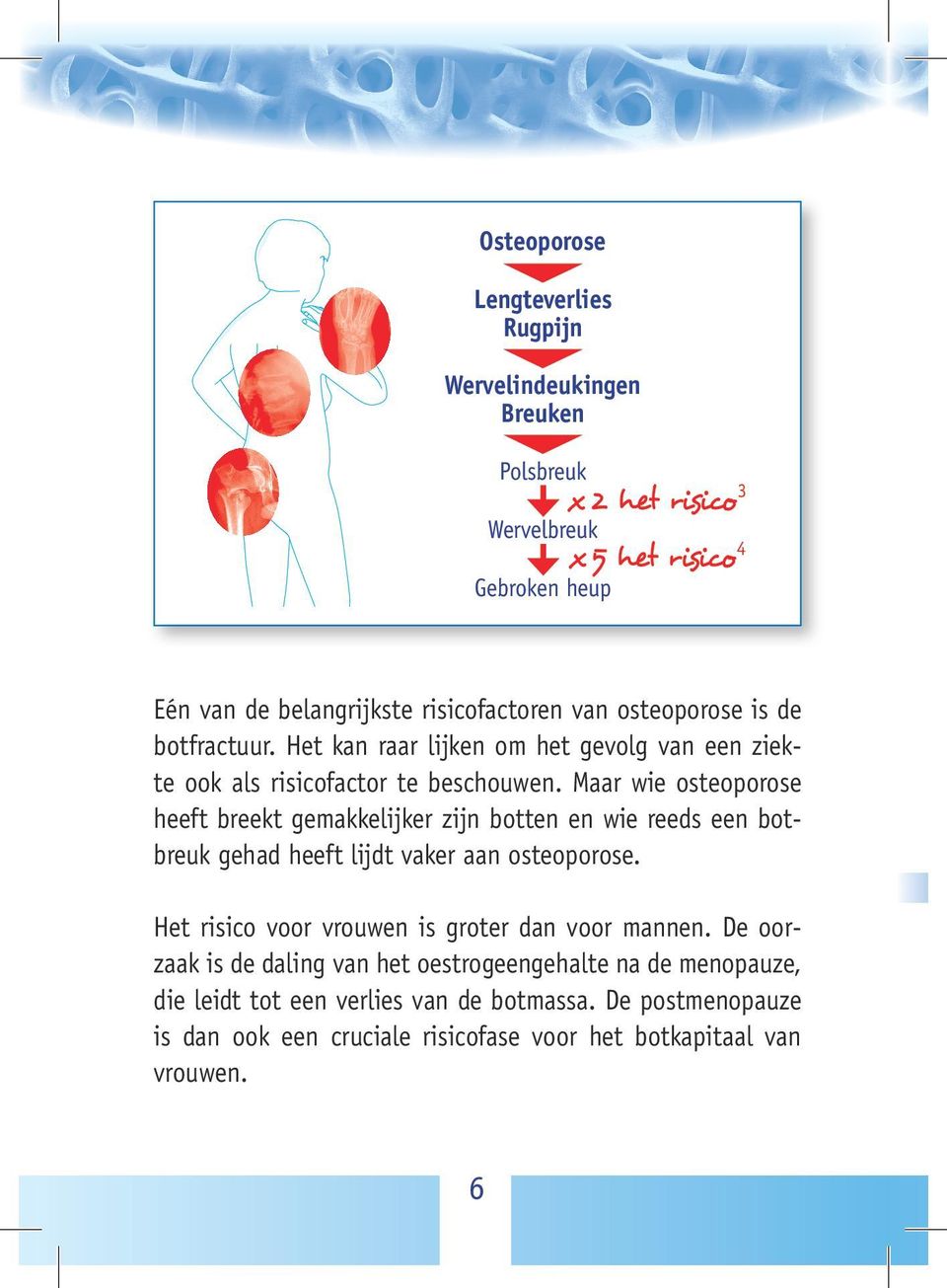 Maar wie osteoporose heeft breekt gemakkelijker zijn botten en wie reeds een botbreuk gehad heeft lijdt vaker aan osteoporose.