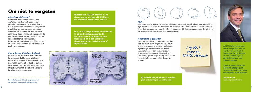 Diverse ziekten kunnen dementie veroorzaken. De ziekte van Alzheimer is er één van: het is de meest voorkomende en bekendste oorzaak van dementie. Kan iedereen Alzheimer krijgen? Ja.