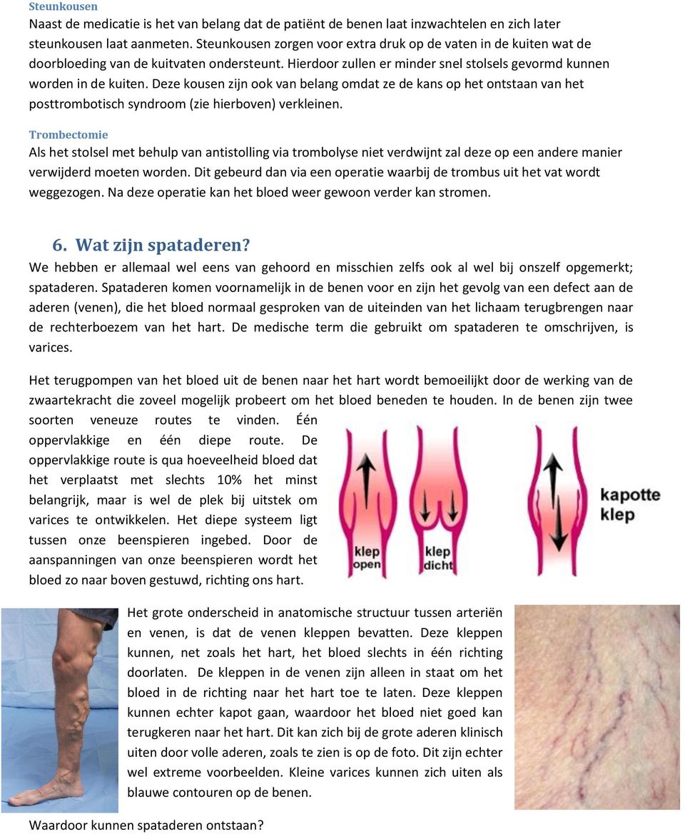 Deze kousen zijn ook van belang omdat ze de kans op het ontstaan van het posttrombotisch syndroom (zie hierboven) verkleinen.