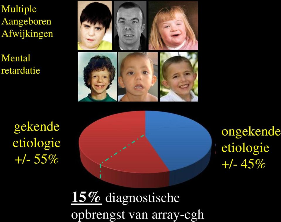 +/- 55% ongekende etiologie +/- 45%