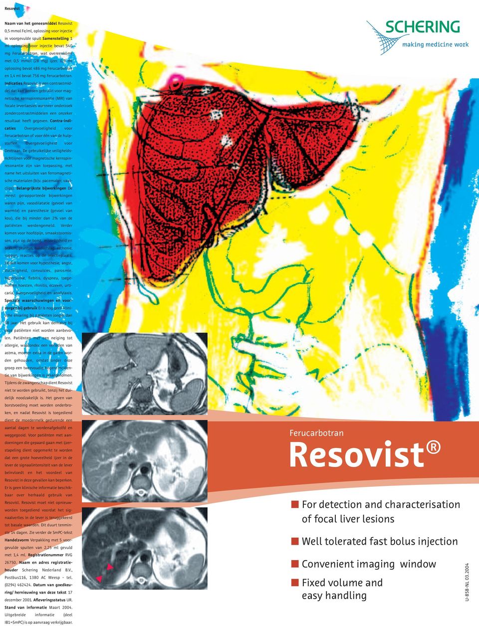 Indicaties Resovist is een contrastmiddel dat kan worden gebruikt voor magnetische kernspinresonantie (MRI) van focale leverlaesies wanneer onderzoek zondercontrastmiddelen een onzeker resultaat