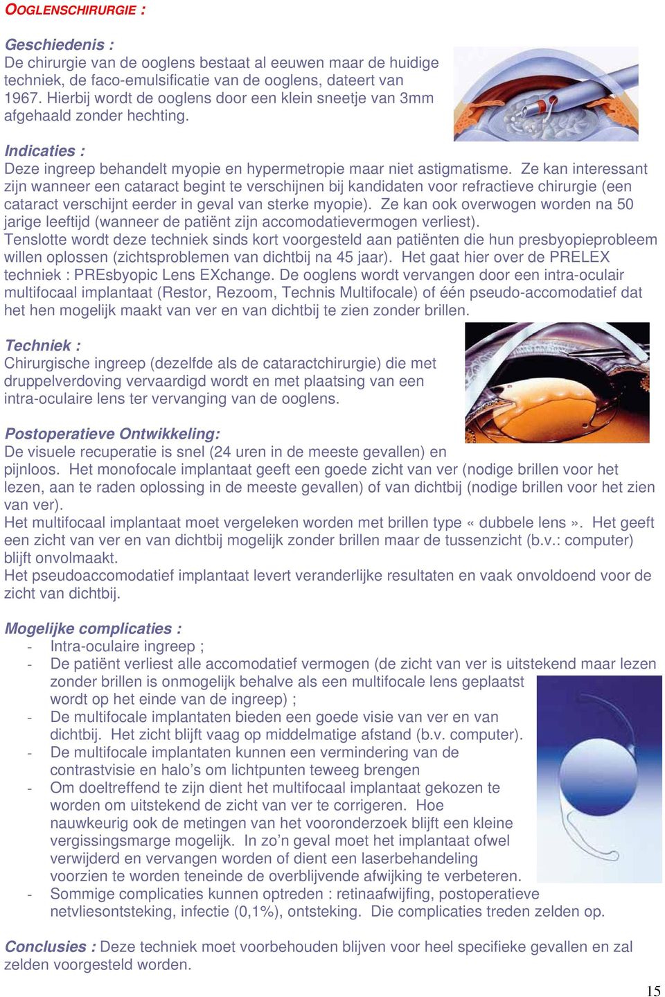 Ze kan interessant zijn wanneer een cataract begint te verschijnen bij kandidaten voor refractieve chirurgie (een cataract verschijnt eerder in geval van sterke myopie).